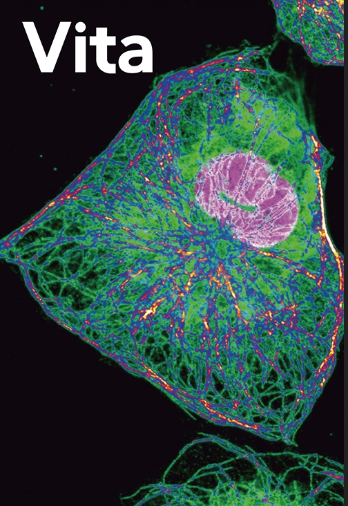 Vita(国际刊号)(OA期刊)(不收版面费审稿费)